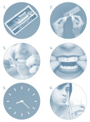 Dantų balinimo juostelės