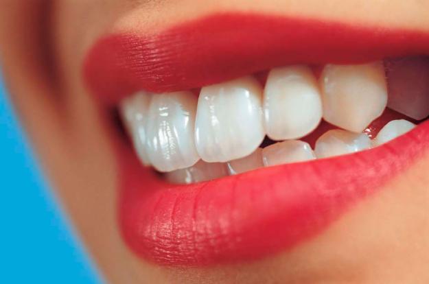 Estetinis plombavimas – (ne)kiekvienam danties defektui ištaisyti?